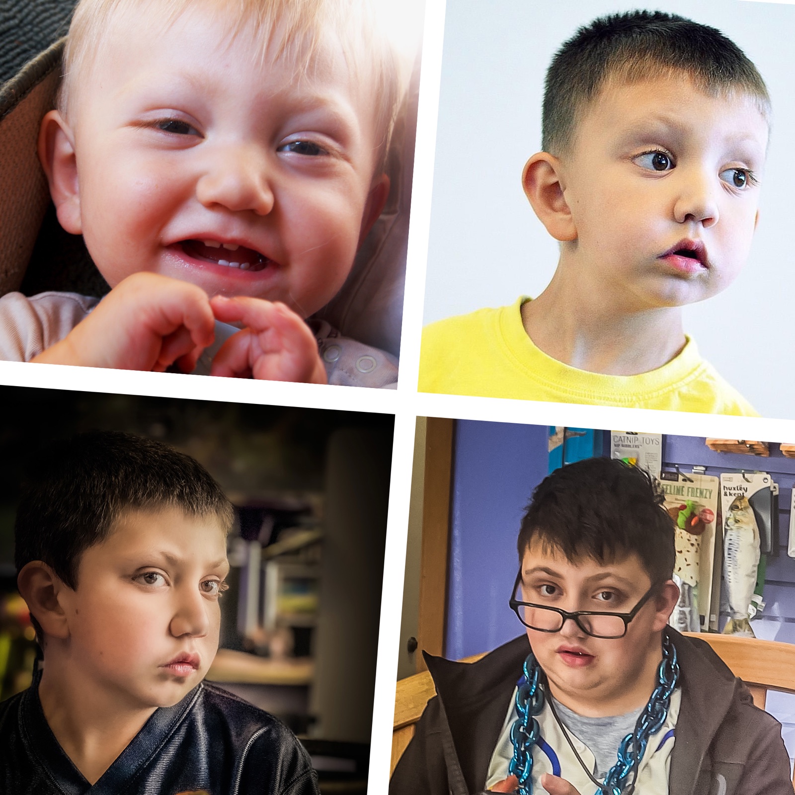 Jonny at four ages, from infancy through adolescence
